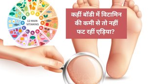 Vitamin deficiency causes cracked heels, Which vitamin deficiency leads to dry heels, Cracked heels due to lack of Vitamin C, Vitamin B3 and skin problems, Dry heels hormonal imbalance,