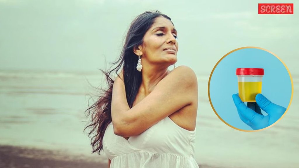 Anu Aggarwal, Urine Anu Aggarwal, Urine