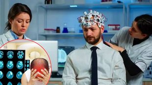 Which vitamin deficiency causes hemorrhage, What is the main cause of brain hemorrhage, brain bleeds cause, Which vitamin deficiency causes brain problems
