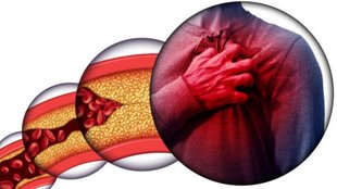 bad cholesterol, veins, natural ways to control cholesterol, arteries, heart health, health tips, cholesterol reduce tips, cholesterol reduce tips in hindi