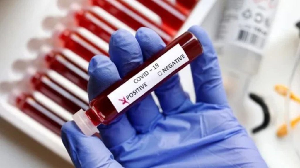 corona | hongkong | singapore |