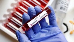 corona virus | covid cases | delhi ncr |