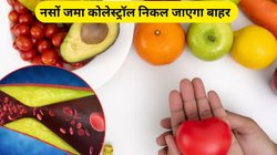 कोलेस्ट्रॉल का काल हैं ये 4 फल, नसों में जमा Cholesterol पिघलने के साथ पाचन तंत्र भी हो जाएगा मजबूत, जानिए फायदे