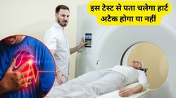 हार्ट अटैक होगा या नहीं? इस 1 टेस्ट से ‘साइलेंट किलर’ का चल जाएगा पता, जानिए कैसे