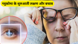 35 की उम्र के बाद महिलाओं में आंखों से जुड़ी इस समस्या का खतरा अधिक, जानिए शुरुआती लक्षण और बचाव