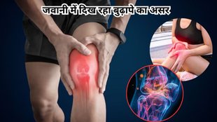 knee cracking sound, knee cracking, why does knee cracking sound, why joint sounds cracking, what is treatment of bones popping