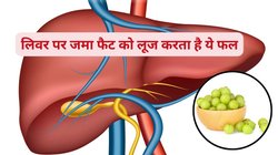 लिवर का बेस्ट फ्रेंड है आंवला, जिगर में जमा सारे टॉक्सिन निकाल देता है बाहर, Fatty Liver भी हो जाता है नॉर्मल