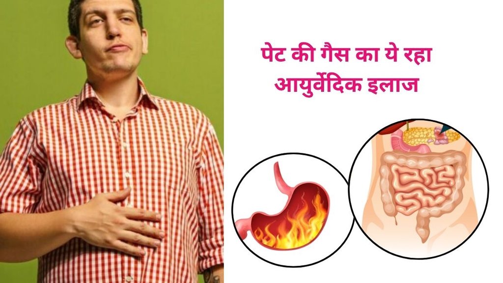 gas, acidity,वात दोष बड़े तो सबसे पहले क्या करें, First Aid for Vata (Vayu) Imbalance by Nityanandam Shree, Gas pain relief home remedies,How to get rid of gas in stomach naturally