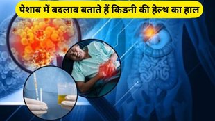 signs and symptoms of kidney failure shows in urine, symptoms of kidney failure, kidney, signs and symptoms of kidney failure, signs of kidney failure