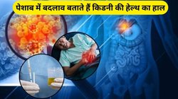 किडनी फेल होने के चेतावनी संकेत हैं पेशाब में ये 3 छोटे बदलाव, एक्सपर्ट से जानिए कैसे करें बचाव