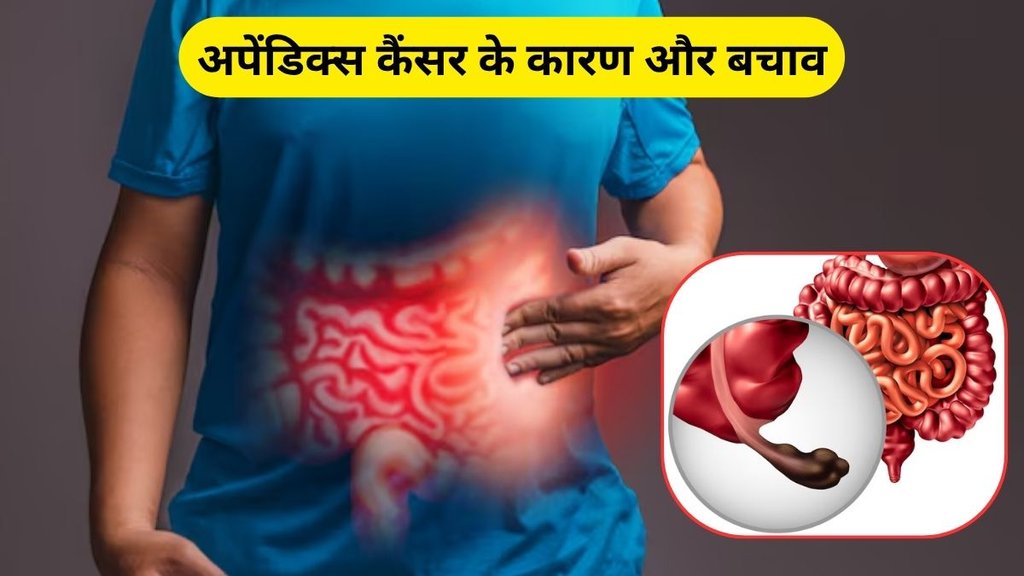appendix, appendix cancer, appendix cancer in young people, young people suffering from appendix cancer, appendicitis