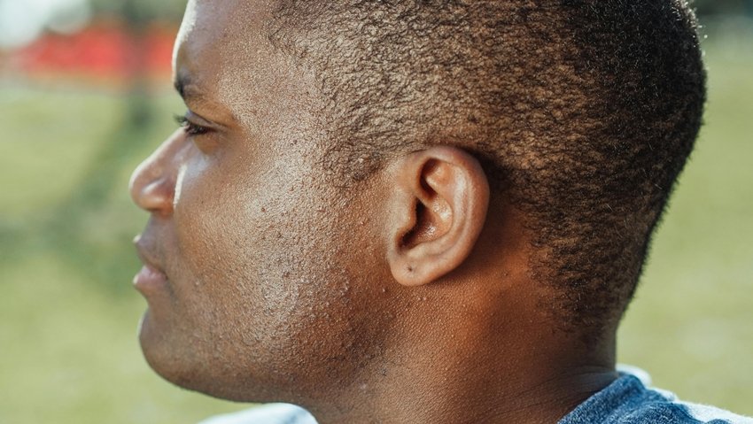 Ear hair causes