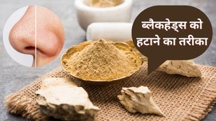 How to remove blackheads | Blackhead Remover | How to remove blackheads on nose