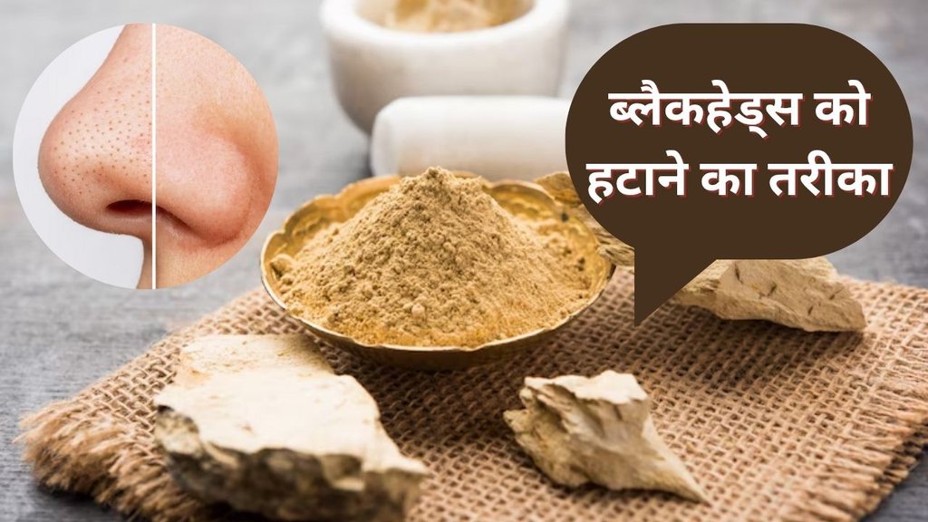 How to remove blackheads | Blackhead Remover | How to remove blackheads on nose