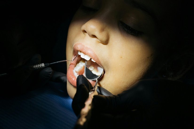 Say Goodbye to Tooth Decay Try These Powerful Home Remedies Today