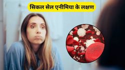 जेनेटिक डिसऑर्डर होता है Sickle Cell Anemia, समय रहते हो जाएं सतर्क और करें लक्षणों की पहचान, ये है बचाव का तरीका