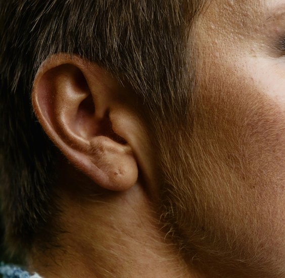 Uncovering the Hidden Meanings Behind Hairy Ears