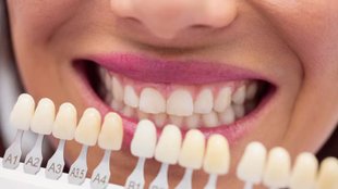 home remedies yellow teeth, Remove yellow teeth stains, Sparkling teeth home remedies