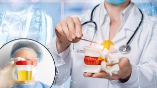 human urine, Human Urine new research, human urine in dental implant, dental implant, dental implant research, Urine Recycling For Bone Implants, Hydroxyapatite - HAp, Hydroxyapatite