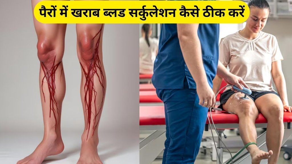 How to increase blood circulation in legs, blood circulation in legs, improve blood circulation in legs, How can increase blood flow to feet
