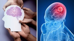 World Brain Tumor Day 2024, World Brain Tumor Day 2024, Can a brain tumor be cured, brain tumor symptoms, What were your first signs of a brain tumor
