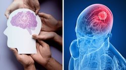 World Brain Tumour Day 2025: शरीर में दिखने लगे ये 5 लक्षण तो ब्रेन ट्यूमर खतरा, बिल्कुन न करें अनदेखा, एक्सपर्ट से जानिए कैसे करें बचाव