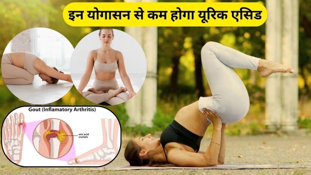 Yoga Asanas for High Uric Acid, best Yoga for Uric Acid, yoga for uric acid control, Shalabhasana for uric acid, Bhujangasana for uric acid