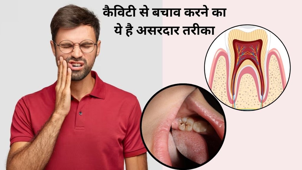 Teeth, TEETH CARE,how to get rid of cavities,cavities cause,cavities sign and symptoms,Can a cavity go away on its own,Can you heal a cavity naturally