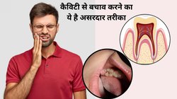 कैविटी से सड़ सकते हैं दांत, ये 4 तरीके हैं Cavities का रामबाण इलाज, तुरंत अपनाएं बच जाएंगे Teeth और सुधर जाएगी ओरल हेल्थ