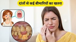दांतों में सड़न और मसूड़ें होने लगे कमजोर तो इन 5 चीजों को खाना कर दें शुरू, दांतों में जमी गंदगी भी जाएगी साफ