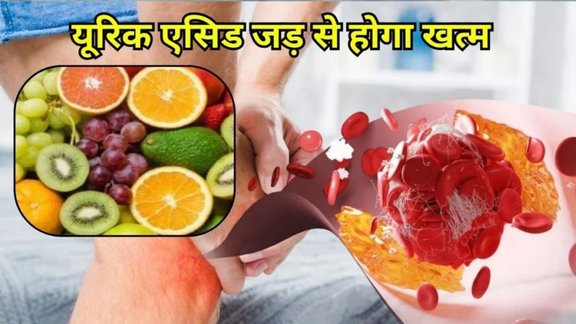 fruits reduce uric acid rapidly, Uric Acid Kaise Kam Kare, uric acid, uric acid kam karne wale fal, gout, Cherry, Pineapple, Kiwi, Fruits Reduce Uric Acid
