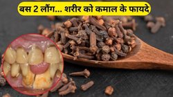 रोज खाली पेट चबा लें सिर्फ 2 लौंग, मसूड़ों और दांतों की समस्या से मिल जाएगा छुटकारा, इन 3 बीमारियों से भी होगा बचाव