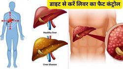 खराब डाइट लिवर को बना देती है फैटी, डॉक्टर ने बताया ये 5 Liver Friendly फूड खाएंगे तो जिगर की उतर जाएगी चर्बी