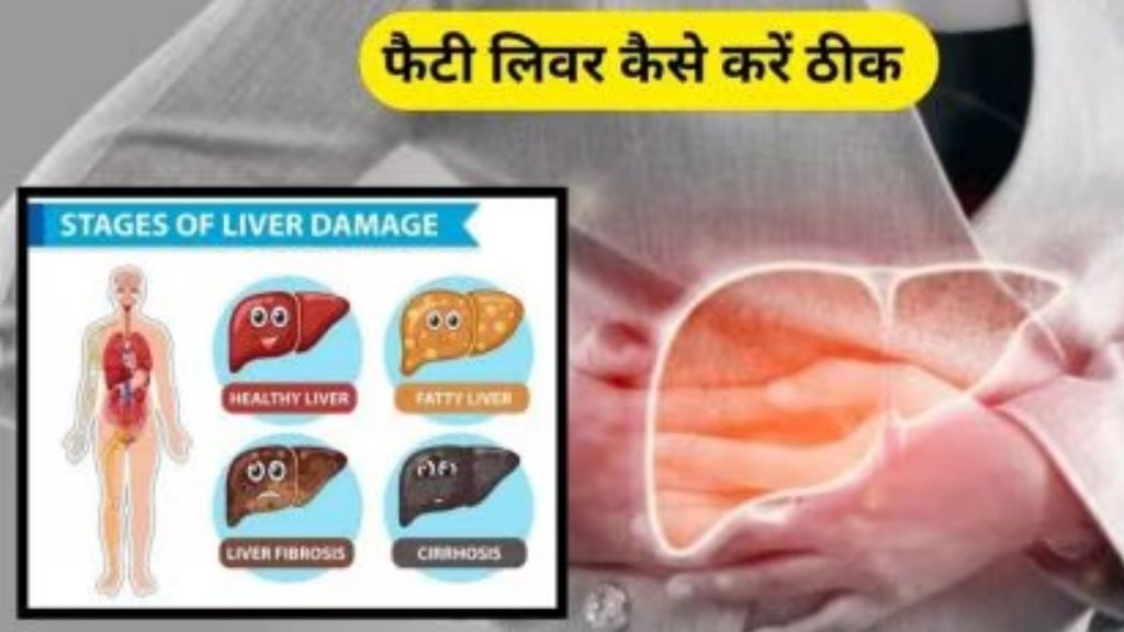 liver health, healthy liver, liver disease, diet and liver healthy, improving liver health, improving diet for liver health