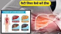 इन 3 आदतों में कर लें सुधार, लिवर की बीमारी का खतरा 50 प्रतिशत तक हो सकता है कम, दिल की सेहत भी होगी अच्छी