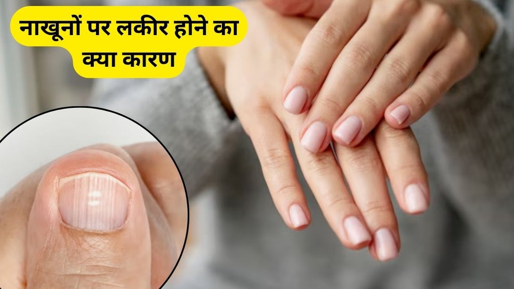nakhun par Nishan kis bimari ka sanket, nails indicate, nakhun par Nishan, nakhun par Nishan ke karan, nakhun par Nishan kyu hota hai, Nails