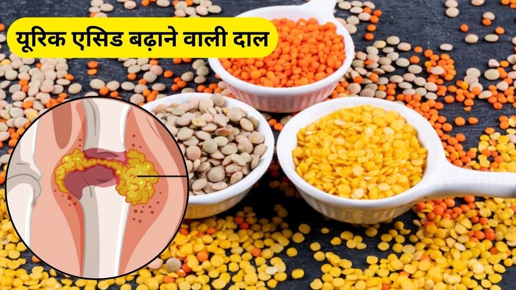 pulses increase uric acid, high uric acid mein kaun si dal nahi khaye, Pulses Bad For High Uric Acid, pulses causing high uric acid
