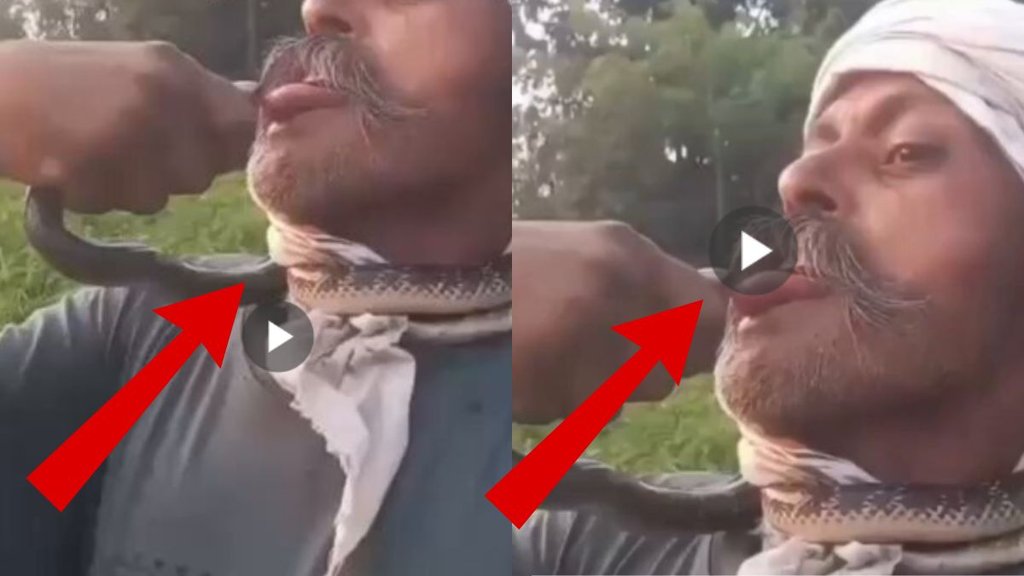 amroha, man bitten by snake