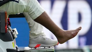 Rishabh Pant,Rishabh Pant fracture update, Ishan Kishan backup