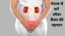 बार-बार पेशाब आना या जलन हो सकती है ब्लैडर कैंसर की शुरुआत, यूरिन से पहचानें Bladder Cancer ये 5 छुपे हुए संकेत