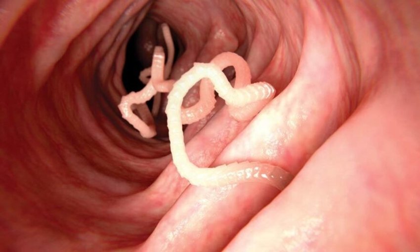 Cabbage Worm Infection and Brain Damage