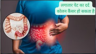 Colon Cancer sign, Colon Cancer,Cancer,Colon, Colon Cancer Signs, Colon Cancer Symptoms,कोलन कैंसर,कोलन कैंसर के लक्षण, Blood in Stools, Recent Onset Constipation,