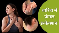 जानें बारिश में फंगल इन्फेक्शन से बचने के लिए क्या करना चाहिए? दाद, खाज, खुजली होने पर अपनाएं ये Fungal Infection Home Remedies