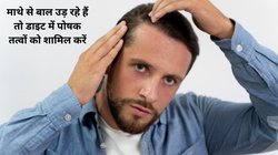 बाल लगातार झड़ रहे हैं और माथा खाली हो रहा है तो इन 4 फूड्स से खुद ही करें इलाज, घनघना कर बढ़ेगी हेयर ग्रोथ, हेयर फॉल और गंजापन होगा दूर