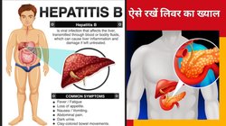 World Hepatitis Day: लिवर में सूजन का मुख्य कारण है हेपेटाइटिस, शरीर में दिखते हैं ये 8 लक्षण, जानें बचाव के उपाय