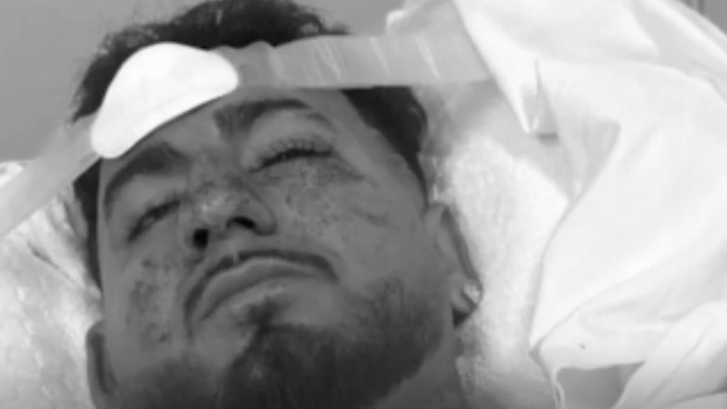 Indian student Charanpreet Singh assaulted, Indian student Charanpreet Singh attacked, Indian student attacked, Indian student attacked in Australia