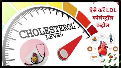 रोज़ इन 5 फूड्स को खाएंगें तो नसों में जमने लगेगी गंदी चर्बी, बढ़ जाएगा LDL Cholesterol