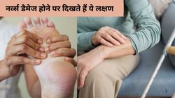 Warning Signs of Nerve Damage: नर्व्स डैमेज होने पर बॉडी में दिखते हैं ये 5 साइन, तुरंत करें पहचान, टल सकता है बड़ा हादसा