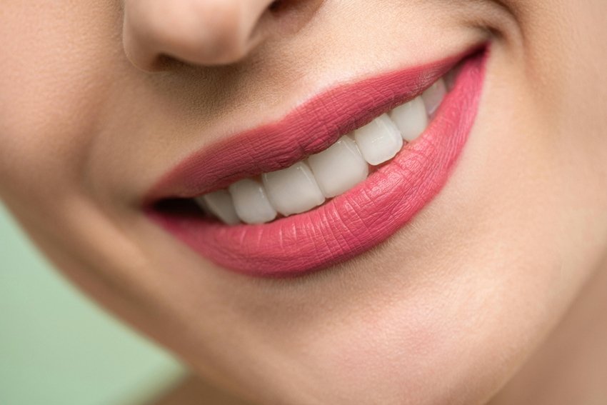 Natural Teeth Whitening Ditch the Chemicals and Try This Trusted Desi Hack