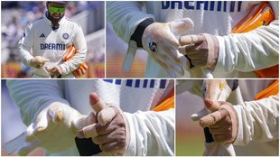 Rishabh Pant injury update, Shubman Gill press conference, IND vs ENG 4th Test 2025